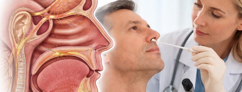 Nasenreflextherapie: anatomische Darstellung der Nasenhöhle und therapeutische Anwendung mit Nasenwatteträger durch medizinisches Fachpersonal