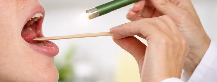 Halsuntersuchung mit Spatel und Licht