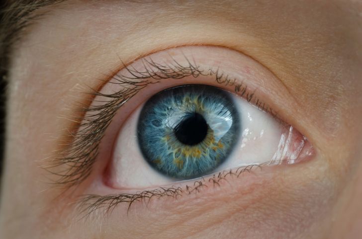 Auge